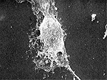 Сканирующая электронная микрофотография клетки HEp-2, лечимой ПНАЭ (50мкг/мл) в течение 48 часов в культурной среде.