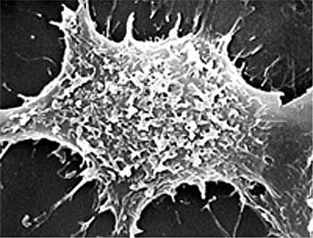 Сканирующая электронная микрофотография клетки HEp-2, лечимой ПНАЭ (50мкг/мл) в течение 24 часов.