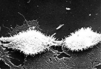 Сканирующая электронная микрофотография человеческой опухолевой клетки HEp-2 в тканевой культуре.
